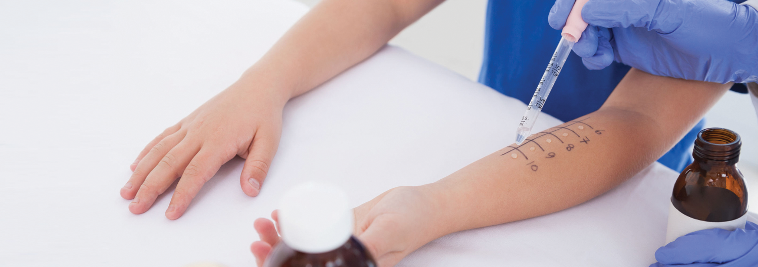SENTA Clinic Testing & Treatment for Allergy Symptoms Testing and Treatment for Allergy Symptoms