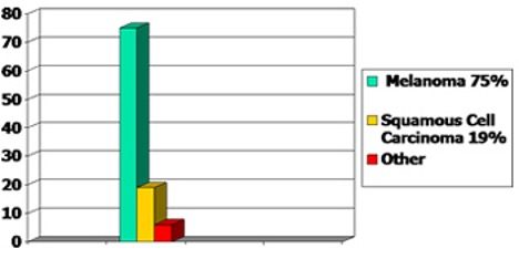 Melanoma of the skin Skin Cancer Types Affect Non-Caucasians Too